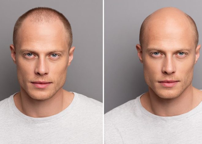 Борьба с выпадением волос: реальный путь к густоте и уверенности